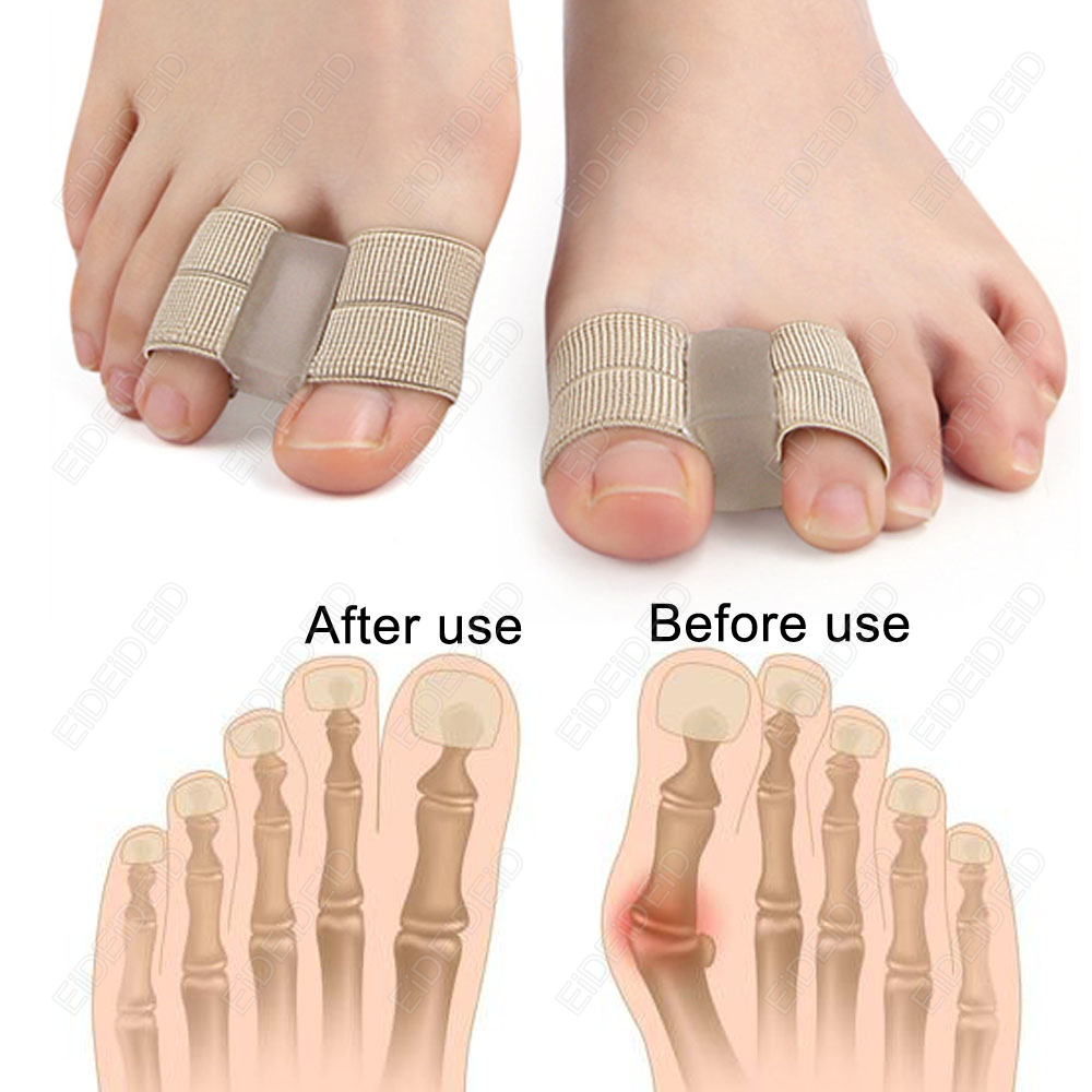 Bunion toe Corrector Orthotics - Women'S Shoes For Bunions ulasan dan harga